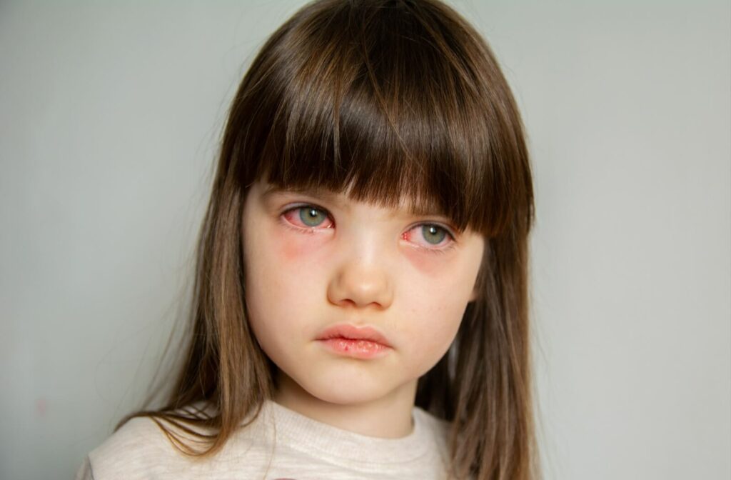 A child stays home from school with a case of pink eye.